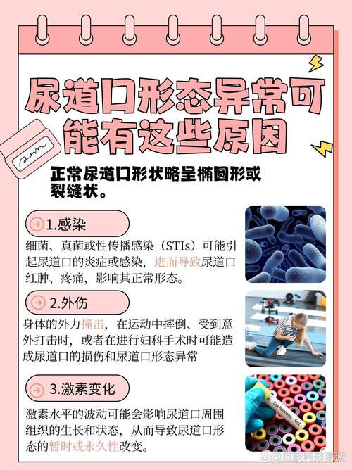 熟妇成人av的相关介绍